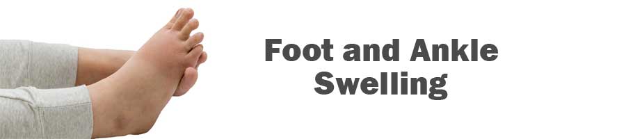 Leg Swelling