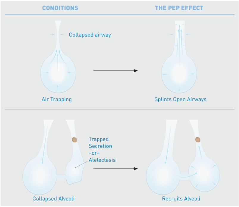 Acapella Diagram acapella diagram