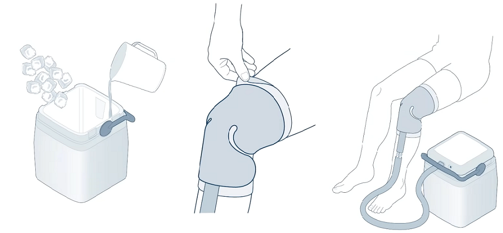 Breg Polar Care Cube Diagram