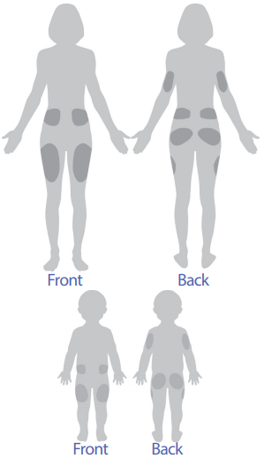 Omnipod Placement Area Optimal Locations Recommendations