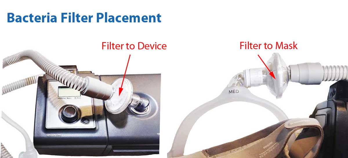 Bateria Filter Placement