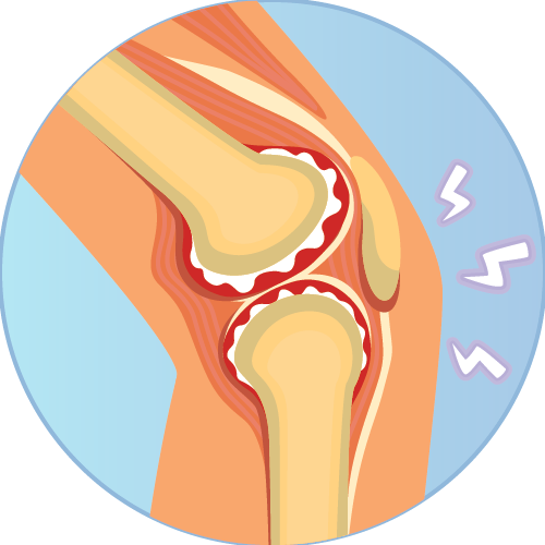 Shop Knee Pain