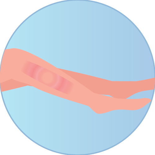 Shop Shin Splints
