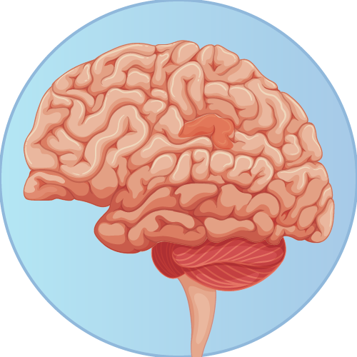 Shop Stroke Patients
