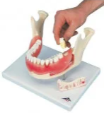 Dental Models