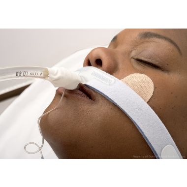 Stabilock Endotracheal Tube Holder - 270
