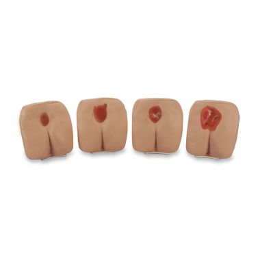 Life/Form Pressure Ulcer/Bedsore Models