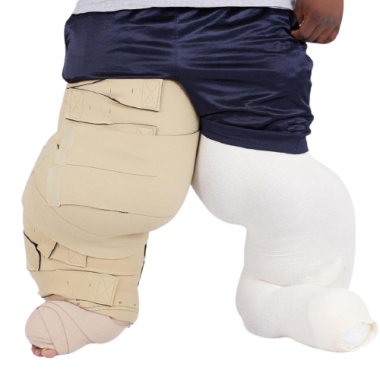 Circaid Lobe Reduction Kit Lymphedema Wrap