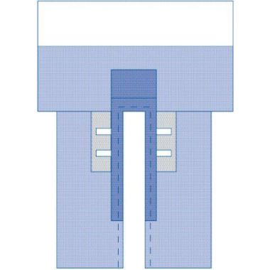 Medline Cardiovascular Split Drapes with Clear Anesthesia Screen and Pouch, Sterile - DYNJP4008