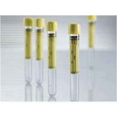 Vacuette Z Urine No Additive Urinalysis Tube, 9.5 mL - 455028