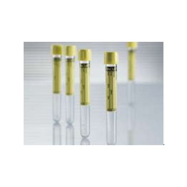 Vacuette Z Urine No Additive Urinalysis Tube, 6.5 mL - 456007