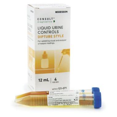Consult Urine Chemistry Test
