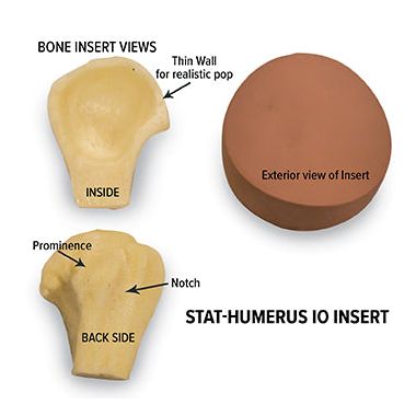 Nasco STAT Humerus intraosseous Insert