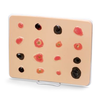 Life/form Skin Cancer Trainer - Enlarged