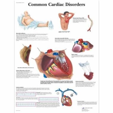 3B Scientific Common Cardiac Disorders Chart