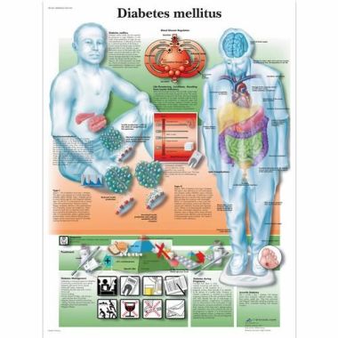 3B Scientific Diabetes Mellitus Chart