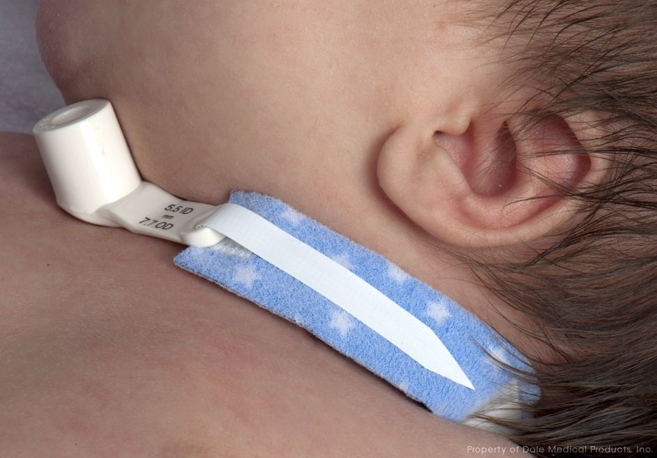 Dale Tracheostomy Tube Holders 240, 244, 242, 241 Vitality Medical