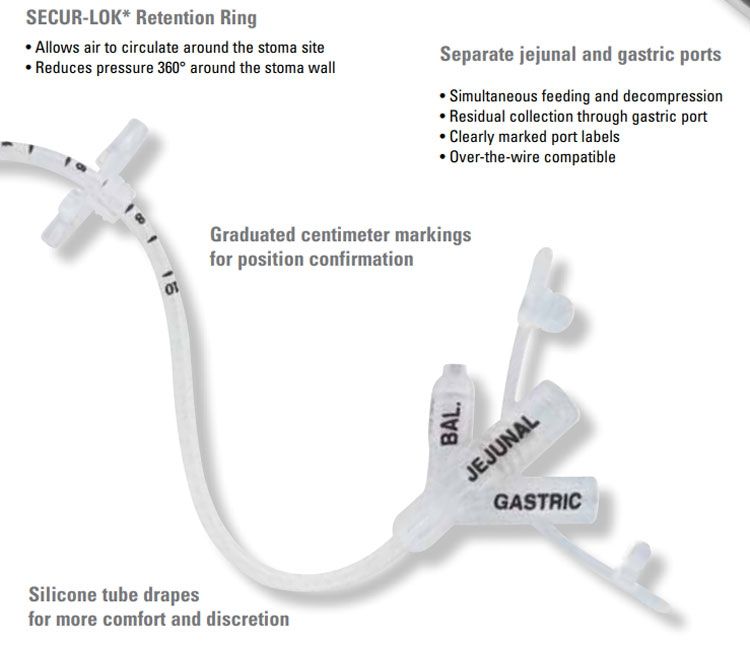 AVANOS MIC KEY GJ Tubing Low Profile GastricJejunal Feeding