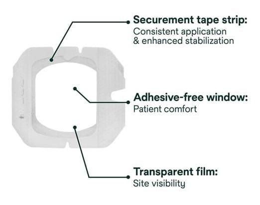 Securement Tape Strip: Consistent Application & Enhanced Stabilization, Adhesive-Free Window: Patient comfort: Transparent Film: Site Visibility