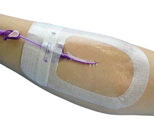 I.V. Advanced Dressing