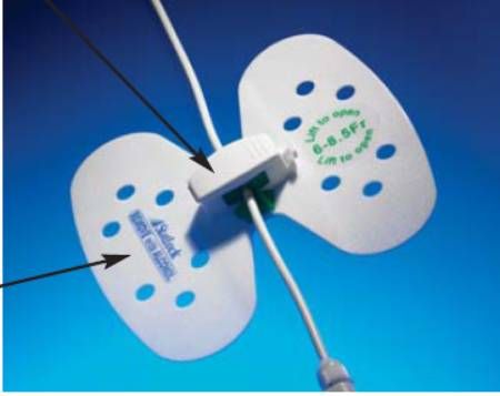 Image 1 of Bard Statlock Universal Plus Stabilization Device