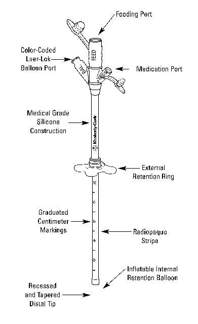 Image 4 of MIC (G Tube) Gastrostomy Feeding Tube