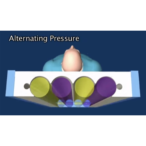 PressureGuard Easy Air XL Alternating Pressure