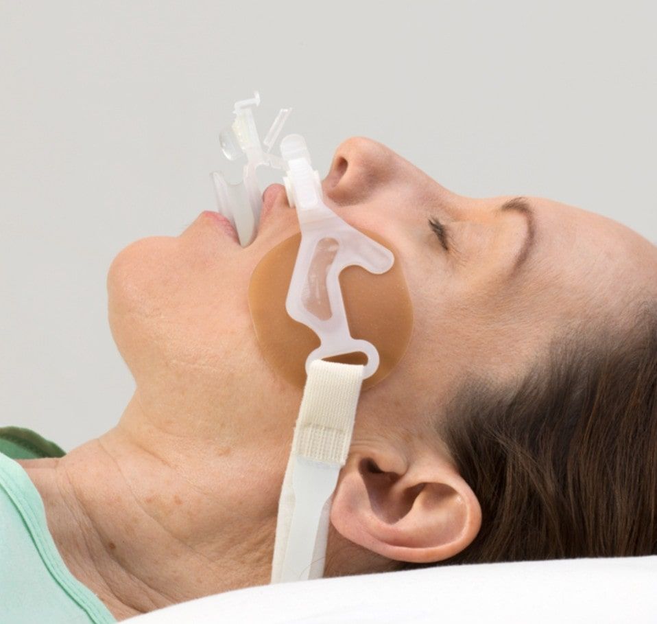 Hollister AnchorFast Guard Endotracheal Tube Fastener - 9800, in use