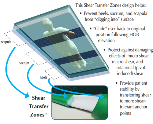 PressureGuard APM2 Mattress Sheer Transfer Zones