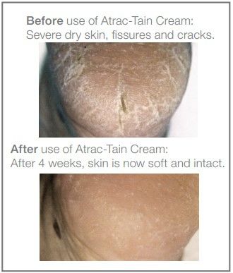 Image 2 of Atrac-Tain Superior Moisturizing Cream