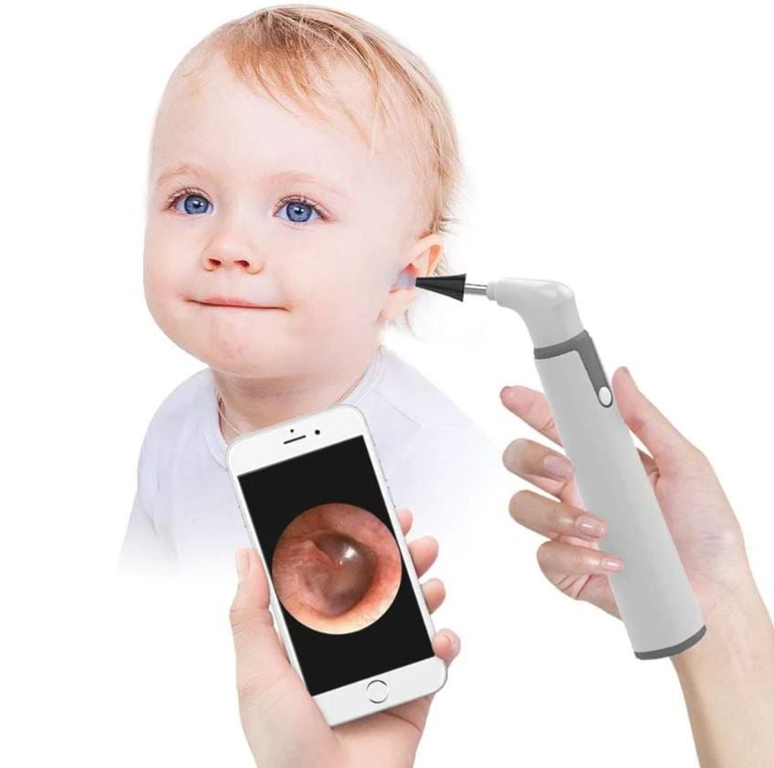ScopeAround in Baby's Ear