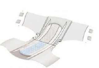 Baribrief Bariatric Briefs Interior Diagram