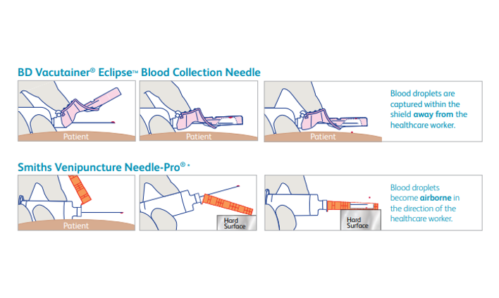 BD Vacutainer Eclipse vs Smiths Venipuncture NeedlePro