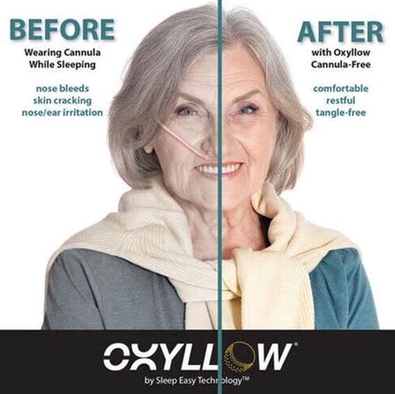 Oxyllow Pillow Benefits