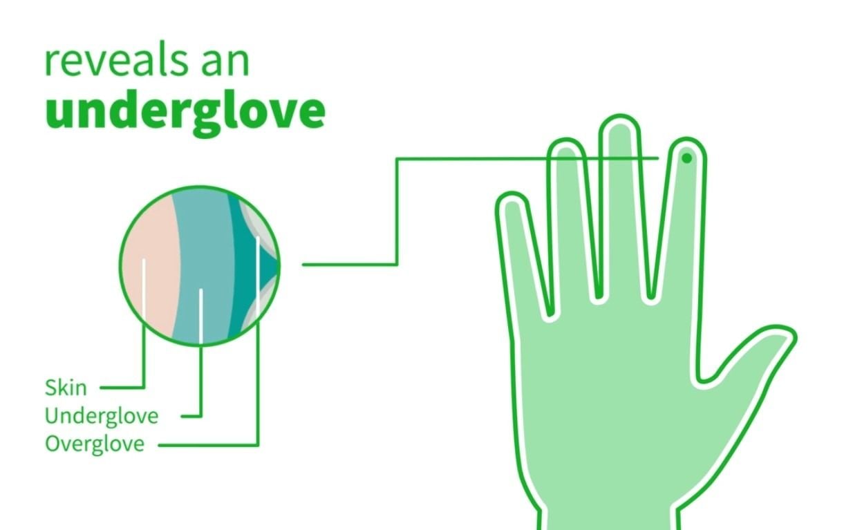 Puncture Indication System reveals underglove
