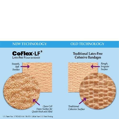 Comparison 2