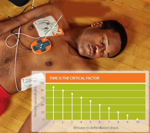 Cardiac Resusicitation