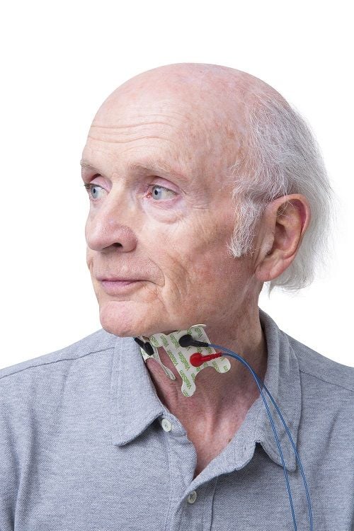 Chattanooga Vitalstim Electrodes Attached to the Anterior Neck