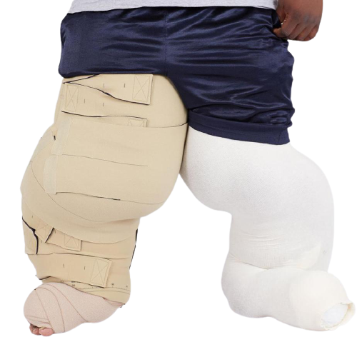 Image 1 of Circaid Lobe Reduction Kit Lymphedema Wrap