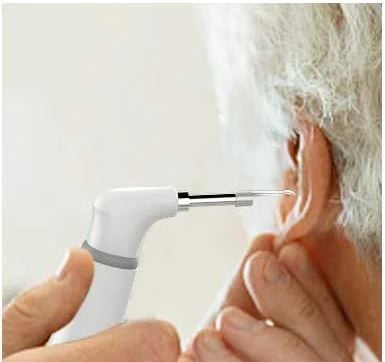 ScopeAround in Use