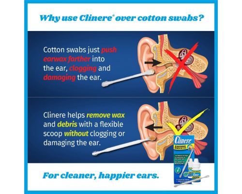 Removal Kit vs Cotton Swabs