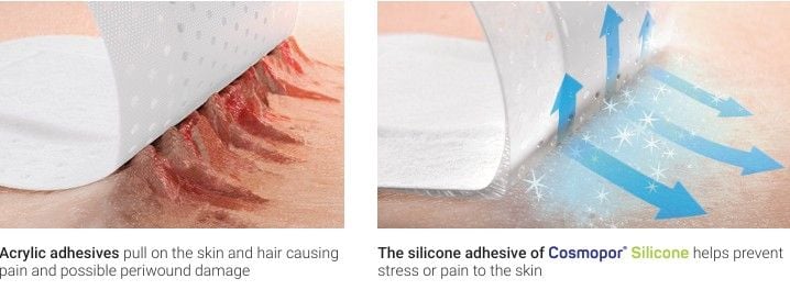 Benefits of Silicone