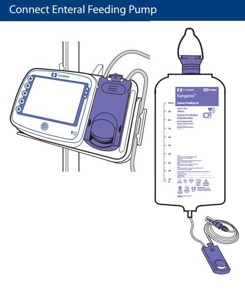 Feeding Pumps