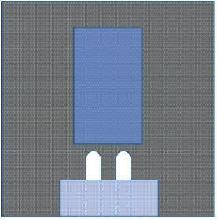 Medline Bilateral Split Surgical Drape - DYNJP4007