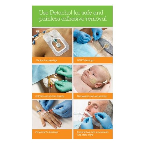 An infographic with different uses for Detachol Adhesive Remover.