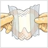 Image 2 of Eclypse Adherent Sacral Super Absorbent Dressing CR3986 | 8-7/10 x 9 Inch