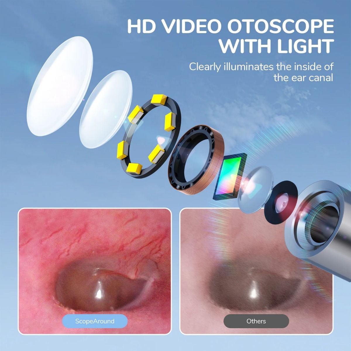Video Otoscope with Light