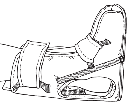 Skil-Care Heel-Float Walker Boot