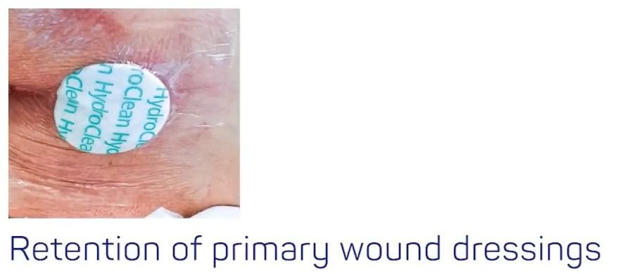Retention of primary wound dressings