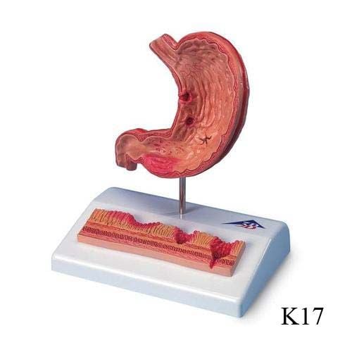 Image 8 of 3B Scientific Stomach Model